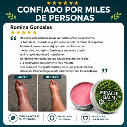 Senzio Miracle Balm | Volvé a sentir tus piernas livianas, sin hinchazón ni pesadez